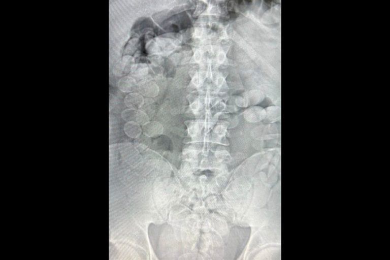 Rafaela: condenan a 4 años de prisión a dos hombres por transportar cápsulas de cocaína como correos humanos